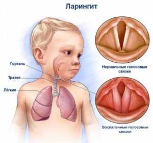 Почему ребенок кашляет по ночам?
