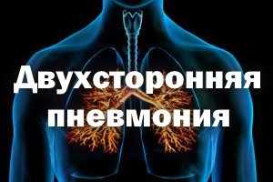 Двухсторонняя пневмония: что это такое?