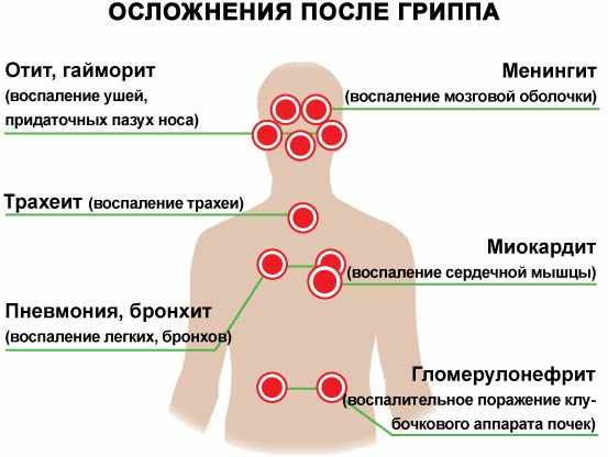 осложнения при орви