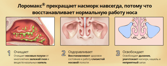 Лоромакс. Средство от хронического насморка