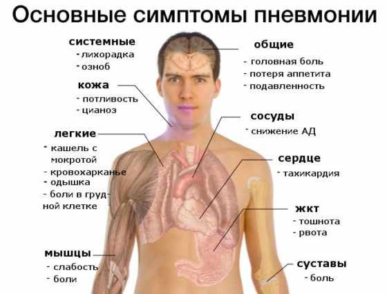 Как распознать пневмонию в домашних условиях