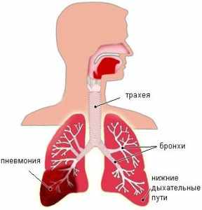 Сколько лечится пневмония у взрослых людей