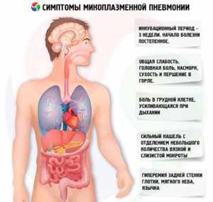 Микоплазма пневмония: симптомы и лечение