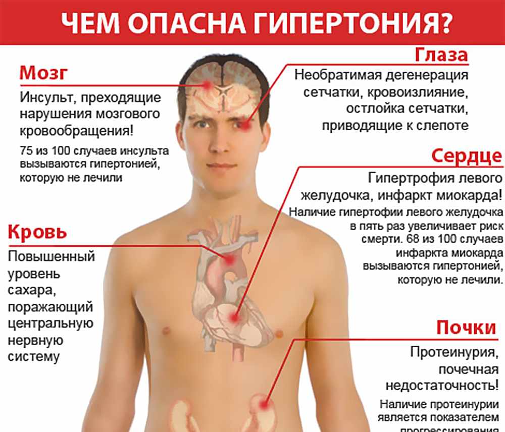 Причины, симптомы и стадии гипертонии