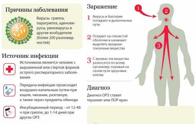 Симптомы атипичной пневмонии у взрослых и детей