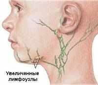 Как распознать признаки туберкулеза у детей?