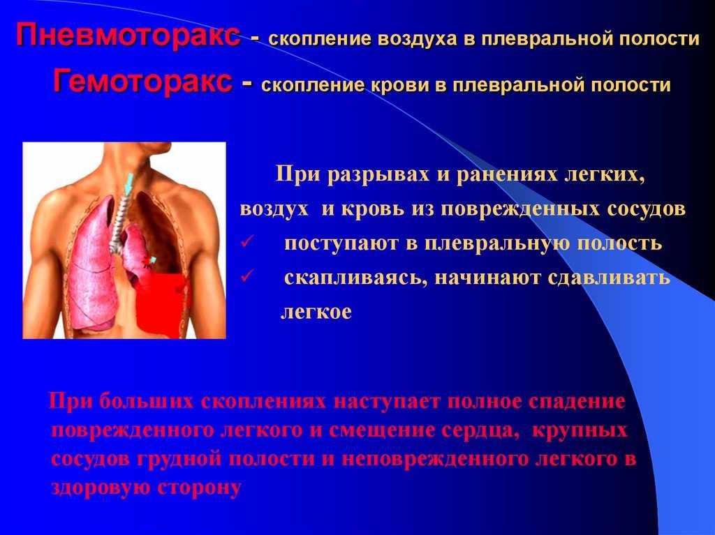 Что такое плевральная полость?