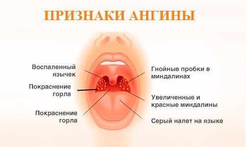 стрептоцид от горла