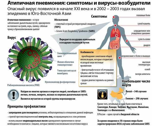 Симптомы атипичной пневмонии у взрослых и детей
