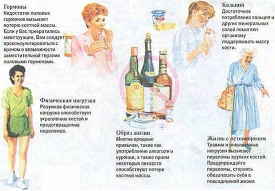 Что такое остеопороз и как его лечить?