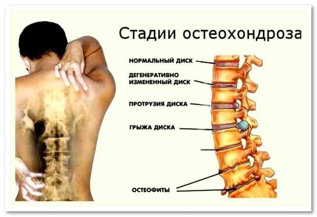 Почему может болеть легкое?