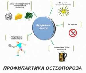 Что такое остеопороз и как его лечить?