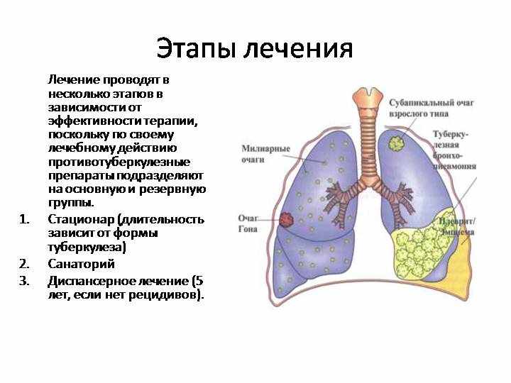 Как сделать туберкулез. Процесс лечения туберкулеза легких. Туберкулёз лёгких лечение. Туберкулез легких лечится. Этапы лечения туберкулеза.