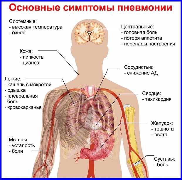 Правостороннее воспаление легких: симптомы и лечение