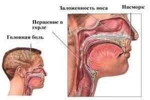 Гайморит у ребенка: симптомы и лечение