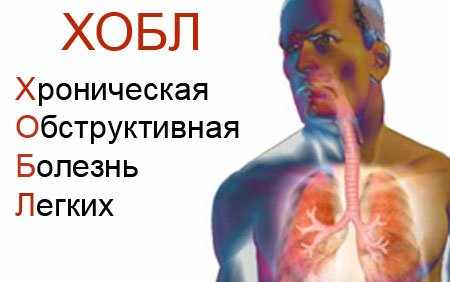 хобл болезнь