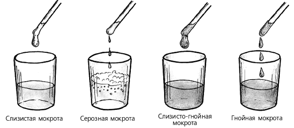 Что делать, если у ребенка не проходит кашель?