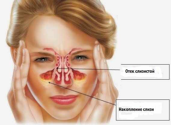 Simptomy